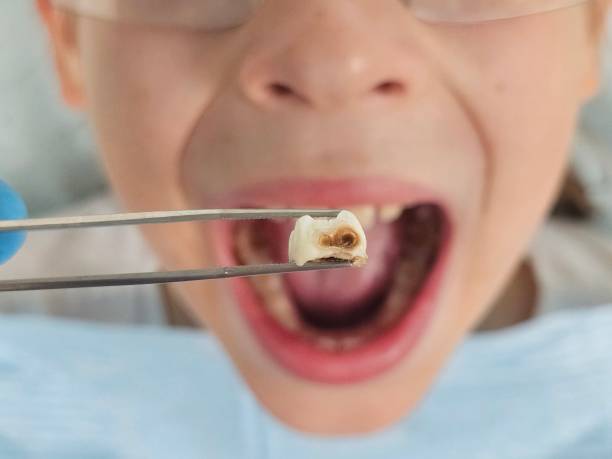 Best Emergency Pediatric Dental Care in Louisiana, MO