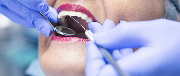 Best Knocked-Out Tooth (Avulsed Tooth) Treatment in Louisiana, MO